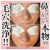 当店の毛穴エステは鼻だけじゃない「ご自身の毛穴ケア、満足していますか？」