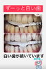 「のんびりくつろぎながらできるメディカルホワイトニングのご紹介」
