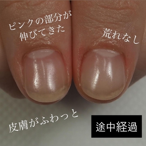 ネイルは無理 深爪でも男爪でも大丈夫 悩める方々に 美爪を追求 ケア重視 福井のネイルサロン Nail Salon Alohaloma アロハロマ のニュース まいぷれ 福井 ネイルは無理 深爪でも男爪でも大丈夫 悩める方々に 美爪を追求 ケア重視 福井のネイルサロン Nail Salon Alohaloma アロハロマ のニュース まいぷれ 福井