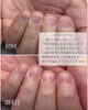 「最初の勇気だけ振り絞ってください【福井/自爪育成】」