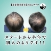 本格発毛育毛スカルプケア横浜市「【半年間で変わった！本格発毛・育毛のビフォーアフター✨】」