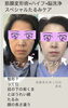 筋膜変形術顔！ほうれい線、むくみ、たるみ、しわ改善「松江エステ！足のむくみに顔のむくみ、肩凝りに筋膜変形術！」