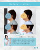 「70代女性姿勢矯正ビフォーアフター」