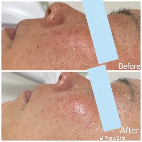 5月キャンペーン 陶肌トリートメントはフルオプションがお得 Blanc Angelique ブランアンジェリーク のニュース まいぷれ 淡路島 5月キャンペーン 陶肌トリートメントはフルオプションがお得 Blanc Angelique ブランアンジェリーク のニュース まいぷれ 淡路島