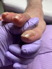 角度を変えた時のお爪の形「巻き爪ケア」