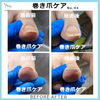 巻き爪ケア事例No.94-2「爪が上にもちあげられてる感じ　巻き爪ケア事例No.94」
