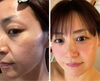 めちゃくちゃツルツル「 追加募集します！！╲午前の部満員御礼╱たるみ改善専門ちひろさんが出雲に」