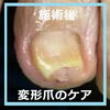 切ることが出来なくなってしまった爪 No.91ー４「自分で切ることが出来なくなってしまった爪 No.91」