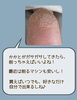 削ればいいってモノじゃない⁈「【角質ケア】削ればいいってモノじゃない⁈」