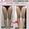 那須塩原　大田原　痩身エステ「【那須塩原・大田原】9月限定　痩身通い放題モニター様募集！！」