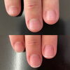 左手「深爪でお悩みの方【札幌市南区川沿 自爪育成サロン nailsalon Rubino】」