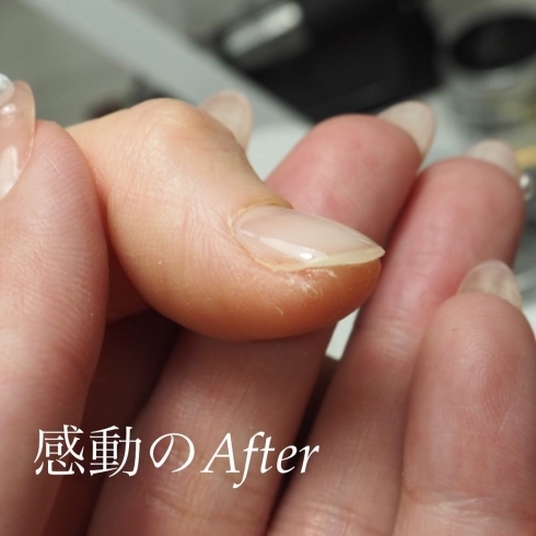 ハンドケア パックリあかぎれさようなら 美爪を追求 ケア重視 福井のネイルサロン Nail Melia Medical Healthcare のニュース まいぷれ 福井 ハンドケア パックリあかぎれさようなら 美爪を追求 ケア重視 福井のネイルサロン Nail Melia Medical Healthcare のニュース まいぷれ 福井