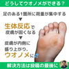 ウオノメに効く魔法のストレッチ01「ウオノメに効く魔法のストレッチ【外反母趾や巻き爪、足の悩み専門整体/千葉県船橋市西船徒歩2分】」