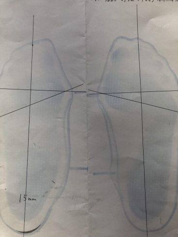 フットプリントをとります「足底板(中敷き.インソール)をつくりませんか？」