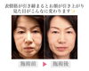 「この先もっと酷くなる前に！【たるみ/しわ/リフトアップ/福井市エステ】」