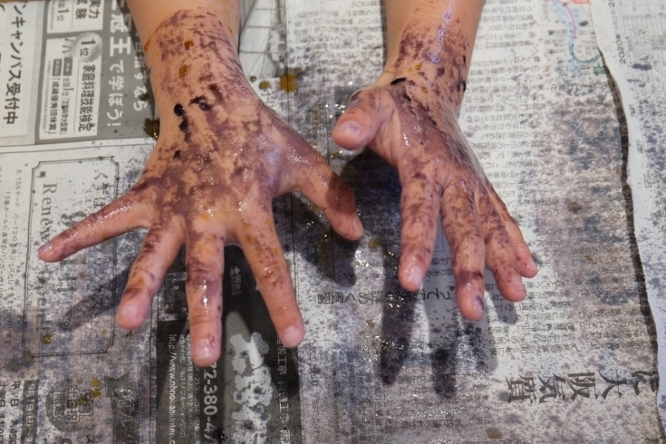 試薬を使って手洗い後の汚れを発色しました。「2月18日　手洗い指導」