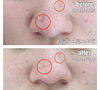 「エステbefore・after」
