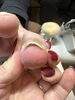 お山のカーブが異常。「巻き爪ケア」