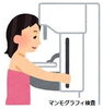 「マンモグラフィ検査？　乳房超音波検査？」