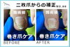 二枚爪からの補正　No.88-3「二枚爪からの補正　No.88」