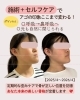 「痛みなし🤲ノーメスノーリスクでお顔を変える🪞」