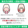 「巻き爪の原因！足の専門家が解説！【 外反母趾や巻き爪、足の悩み専門整体/千葉県船橋市西船徒歩2分】」