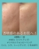 鏡を見るのが楽しくなった！ 金沢区 たるみ ハイフ HIFU リフト