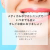 メディカルホワイトニング「歯医者さんでホワイトニングした事ある方！」