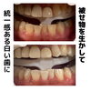 メディカルホワイトニング「ご質問」