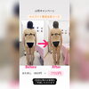 頑固なセルライトをほぐし、痩せやすいお身体作りを！「12月キャンペーン★セルライト撃退全身コース7700円」