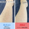 「ホームページに「脱毛経過・Before After」のページが誕生！！」