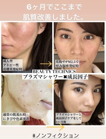 モニター様 募集 Looseのニュース まいぷれ 佐世保 モニター様 募集 Looseのニュース まいぷれ 佐世保