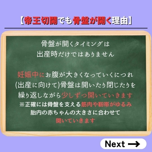 帝王切開と骨盤の話３「【帝王切開でも骨盤は開くの？】」