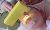 細やかな鼻の下も「お顔の脱毛」
