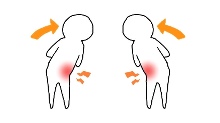 側屈「【腰痛】腰痛の二つのパターンその2〜原因と対策〜【腰痛・坐骨神経痛・整体・那須塩原・大田原】」