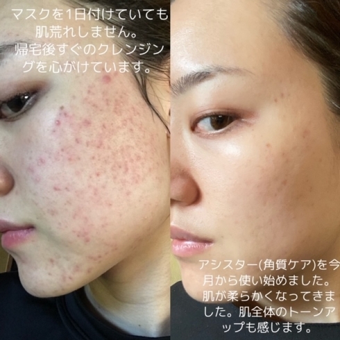 肌改善☆ドクターリセラADSシリーズ化粧品‼ | Salon Ito(サロンイトウ