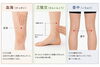 血海（けっかい） 三陰交（さんいんこう） 委中（いちゅう）「【宮司の健康歳時記７月号】エコノミークラス症候群の予防対策」