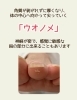つま先にもウオノメ⁈「【角質ケア】つま先にもウオノメ⁈」