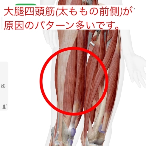 大腿四頭筋が原因のパターンが多いです「膝の痛い人〜❗️【新潟市東区　整体　姿勢　矯正　アロマ　リラクゼーション　ドライヘッドスパ　足つぼ　近くの整体院】」