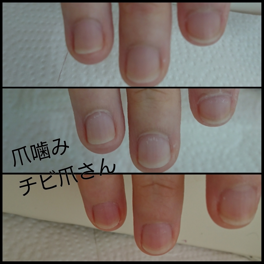 爪噛みさん 爪噛みさん